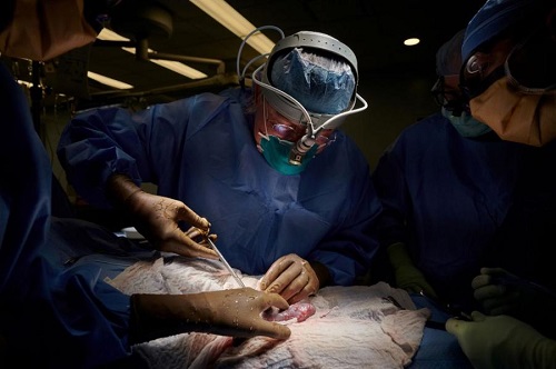 Izinkan Transplantasi Ginjal Babi ke Tubuh Manusia, Berikut Isi Lengkap Fatwa Al-Azhar
